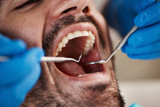 Best Emergency Tooth Extraction in State College, PA